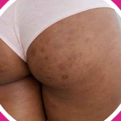 Dark marks: Booty