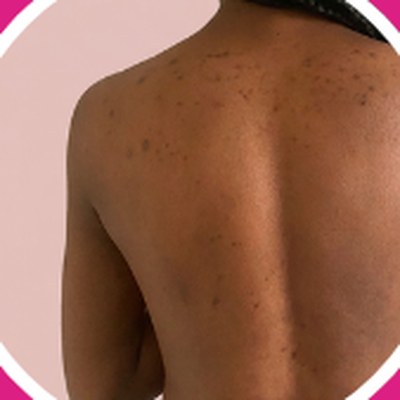 Dark marks: Back